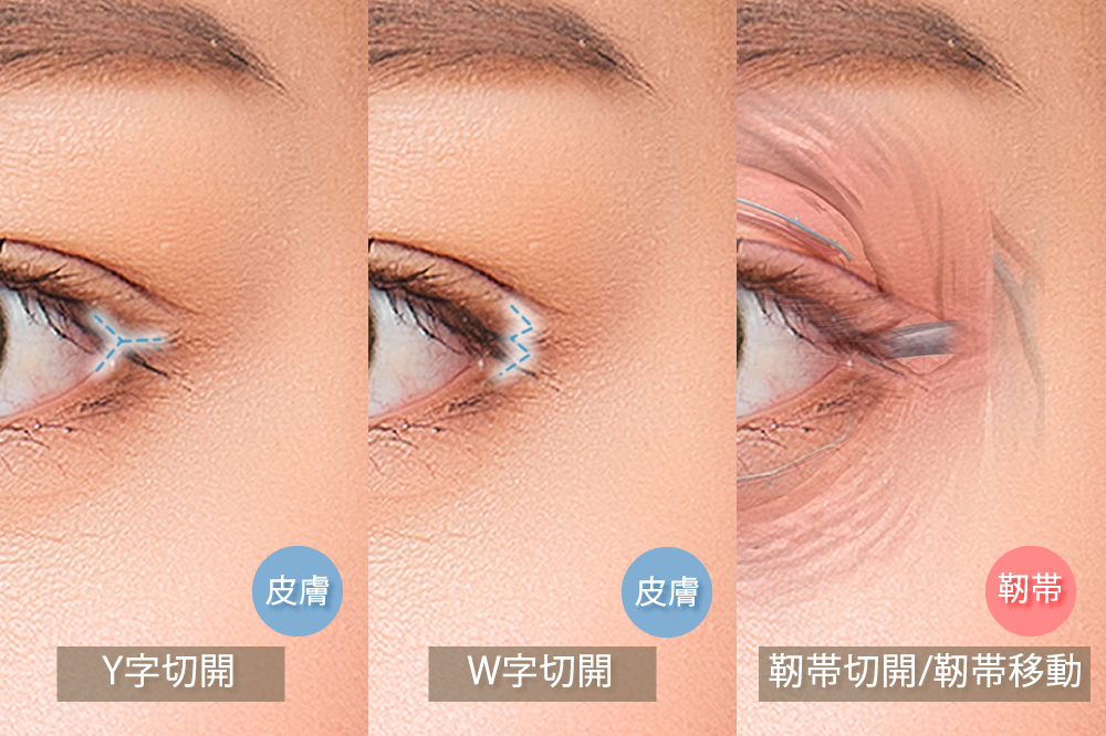 e79baee5b0bbe58887e9968be79787e4be8be381aee5ae9fe99a9be381a8e58ab9e69e9ce38292e5beb9e5ba95e8a7a3e8aaac