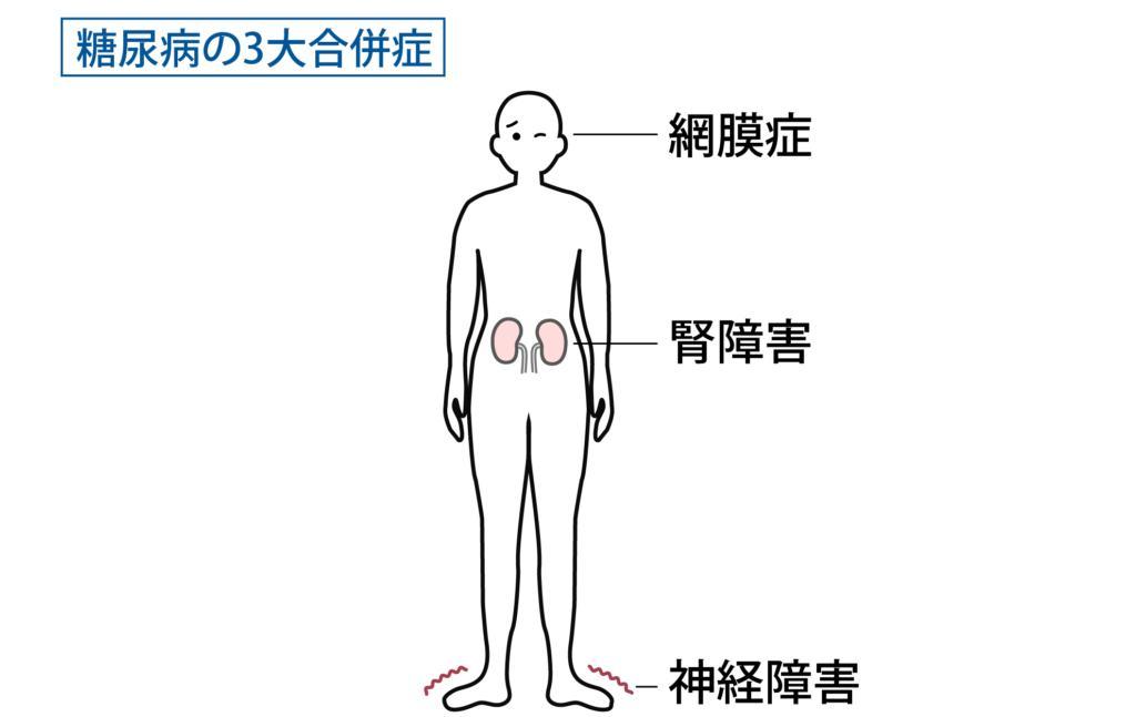 e7b396e5b0bfe79785e79982e9a48ae68c87e5b08ee5a3abe8a9a6e9a893e381abe890bde381a1e3819fe79086e794b1e381a8e5afbee7ad96e381bee381a8e38281