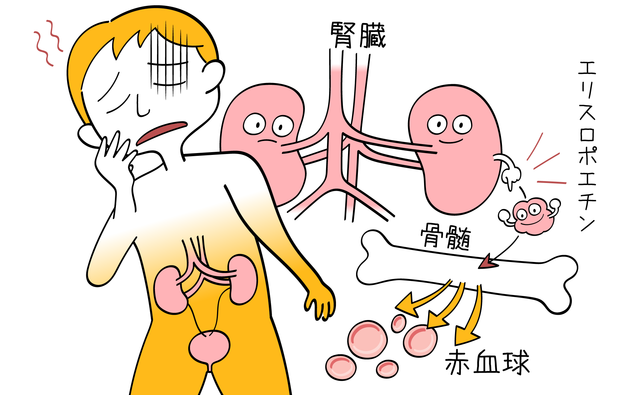 e8b2a7e8a180e381a8e6adbbe4baa1e381aee996a2e980a3e680a7efbc9ae585b7e4bd93e4be8be381a8e383aae382b9e382afe8a681e59ba0